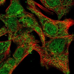 SDR39U1 Antibody, Novus Biologicals 25 &mu;L | Buy Online | Novus Biologicals | Fisher Scientific